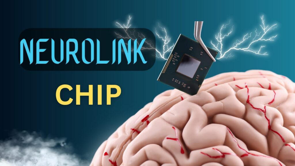 Neurolink 